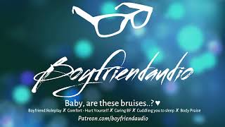 Baby Are These Bruises Boyfriend RoleplayComfortingHurt GFSpooning to SleepSoft ASMR [upl. by Rolyak]