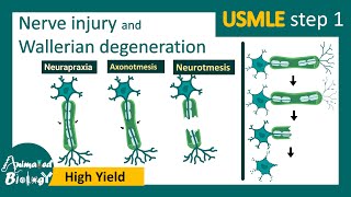 Nerve injury  Wallerian degeneration  Mechanism of wallerian degeneration  USMLE [upl. by Mehitable]