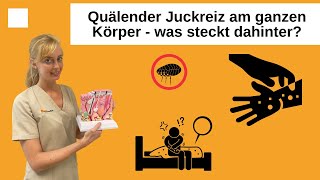 Skabies Quälender Juckreiz am ganzen Körper durch die Krätzmilbe [upl. by Anair]