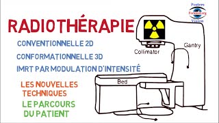 La Radiothérapie Techniques Ex cancer de la Prostate Radiotherapy [upl. by Selene]