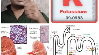 Diuretic TypesMechanismNephronKidneyBangali Doctorclinical Pharmacologist [upl. by Zaneski429]