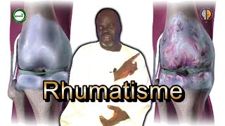 1  Rhumatisme Symptômes et Causes  Pr Ousmane Ndiaye  SAMA XALAAT TV [upl. by Saucy]