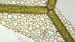 Hydrodictyon a netlike green alga [upl. by Maze]