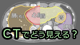 CTで臓器や病気を見てみよう【胸部＆腹部】救急CTの基礎の前の話（看護師さん向け） [upl. by Fabron]