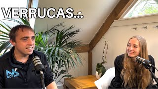 What is the best verruca treatment  Is it Swift verruca treatment  podiatry podcasts [upl. by Ybhsa545]