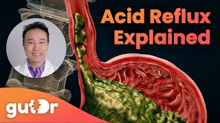 What Is Acid Reflux  The GutDr Explains 3D Gut Animation [upl. by Yrrej]