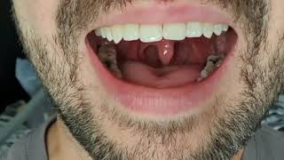 Mouth amp Uvula [upl. by Elleirb295]