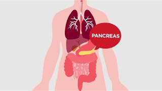 What is cystic fibrosis [upl. by Ilowell879]