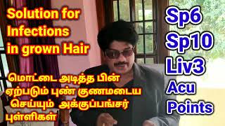 Sp6  Sp10  Liv3  Acu Points for infection in grown Hair  Anti Allergic  தலையிலுள்ள புண்களுக்கு [upl. by Barcus180]