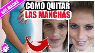 Cómo quitar las manchas en la cara del embarazo [upl. by Dylan694]