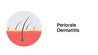 Periorale Dermatitis  Erkrankungen der Haut mit Infoleiste [upl. by Carrington]