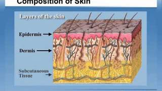 Hydrocolloid Technology amp SureSKIN II Dressings [upl. by Fernandez513]