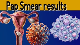 Pap Smear Results Explained under 3 minutes [upl. by Odom]