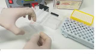 Hemoglobin electrophoresis procedure [upl. by Asenav]