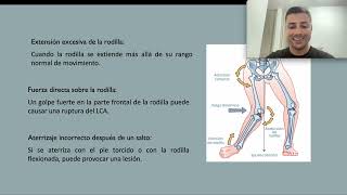 Ruptura de ligamento cruzado anterior [upl. by Orag]