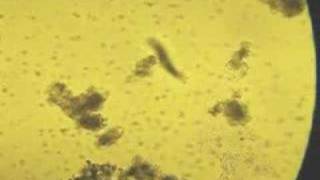 what kind of Paramecium is this [upl. by Almat]