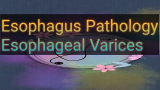 Esophageal Varices esophagus pathology part4 robbins [upl. by Aneekan]