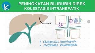 Patofisiologi Ikterus 2A2B  Peningkatan Bilirubin Direk Kolestasis Intrahepatik [upl. by Enitsugua347]