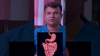 What is Colonoscpy  colonoscopy colonoscopytest colonoscopydiet colonoscopyvideo [upl. by Kenny759]