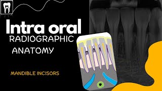 Normal radiographic anatomical landmark Intraoral Radiographic Anatomy of the mandible incisors [upl. by Oirad]