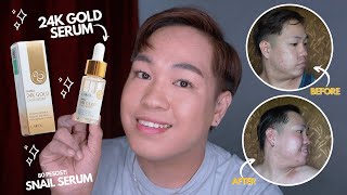 BEST WHITENING SERUM LAIKOU 24K GOLD SNAIL SERUM REVIEW 4K GOLD SERUM GOOD FOR ACNE BREAKOUTS [upl. by Oric]