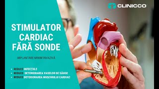 STIMULATORUL CARDIAC FĂRĂ SONDE [upl. by Vikky]