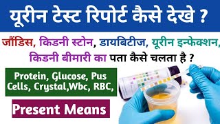 How to Read Urine Routine Test Report  Urine Test Report Explain in Hindi [upl. by Josephina]