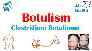 Botulism Clostridium Botulinum Pathogenesis Symptoms Diagnosis Treatment Prevention [upl. by Inad453]