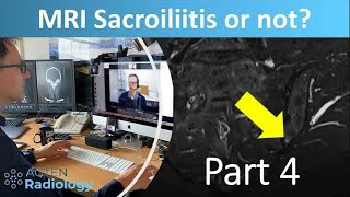 Sacroiliitis or not  with Prof Hermann  Part 4 [upl. by Anik794]