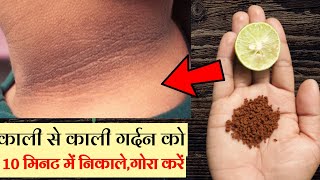 10 मिनट  काली से काली गर्दन को गोरा करने का सबसे अचूक उपाय  Dark Skin Treatment [upl. by Leviralc]