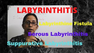 055 Labyrinthitis otitismedia vertigo [upl. by Ikkim]