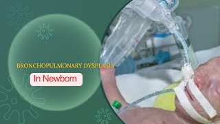 BRONCHOPULMONARY DYSPLASIA CHRONIC LUNG DISEASE  DEFINATION DR MEENA CHOUDHARY [upl. by Nezah]