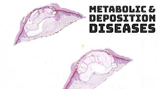 Metabolism amp Deposition Diseases in Skin dermatology dermpath pathology board review [upl. by Teriann]