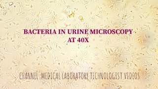 Bacteria under urine microscopy at 40X UTI [upl. by Amleht]