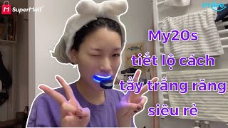 My20s review SmileeExtra Kit tẩy trắng răng tại nhà phiên bản 20 [upl. by Andriana]