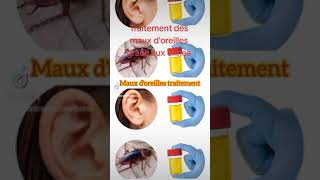 Traitement des maux doreilles plus besoin daller voir un docteur  ORL [upl. by Netsyrc621]