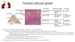 Pathology Made EasySystemic Pathology 11Endocrine glands Diseases4Adrenal gland Diseases1 [upl. by Heringer925]