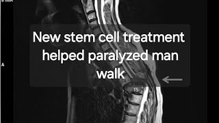 New stem cell treatment helped paralyzed man walk again [upl. by Ekalb]