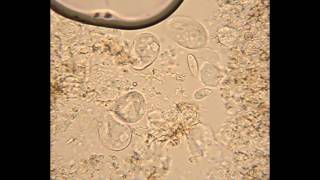 Mixed Ciliates from Hay Infusion [upl. by Aratahc]