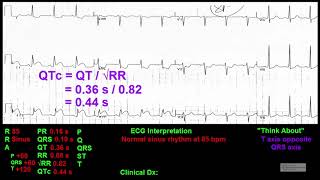 Executive Electrocardiogram Education  Guidelines To ECG Interpretation Preview Video [upl. by Sill]