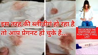 Implantation bleeding vs periods।।इम्प्लांटेशन ब्लीडिंग क्या है कब होती है कितने दिन तक होती है। [upl. by Resiak]