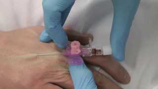 Cannulation How to gain IV access [upl. by Dang]