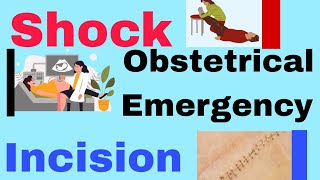 DEFINITION  SHOCK  OBSTETRICAL EMERGENCY INCISION [upl. by Stacia]