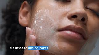 Clear Acne and Prevent New Breakouts │ CeraVe Skincare [upl. by Ahsuoj]