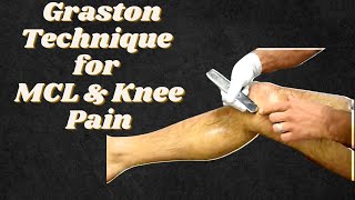 Graston for Knee Sprain of the MCL [upl. by Yrrag]