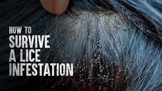 How to Survive a Lice Infestation [upl. by Nitsa]