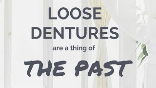 LOOSE DENTURES are a thing OF THE PAST [upl. by Arbma]