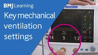 Key settings for a mechanical ventilator  BMJ Learning [upl. by Alomeda568]