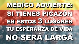 ¡CUIDADO 🔴 Si Sientes PICAZÓN en Estas Áreas Ve al MÉDICO [upl. by Oijres]