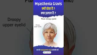 Myasthenia Gravis cause Symptoms and Treatment myastheniagravis causes symptoms treatment [upl. by Joline744]